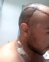 Virginopolitano diagnosticado com câncer clama por justiça após ter complicações de saúde por demora no atendimento médico