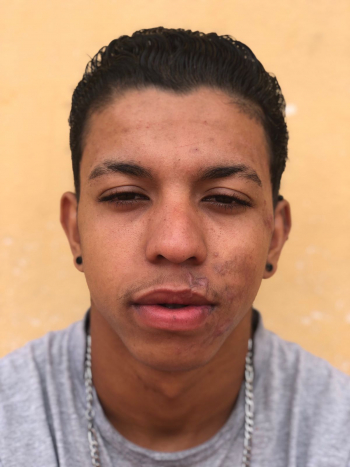 ESPAÇO SOLIDÁRIO: Familiares e amigos divulgam campanha em prol de jovem guanhanense que teve várias fraturas bucais após um acidente de bicicleta Saiba como ajudar!