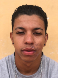 ESPAÇO SOLIDÁRIO: Familiares e amigos divulgam campanha em prol de jovem guanhanense que teve várias fraturas bucais após um acidente de bicicleta Saiba como ajudar!
