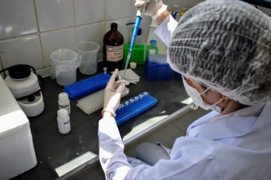 DIAMANTINA: Laboratório da UFVJM já está fazendo testes do Coronavírus