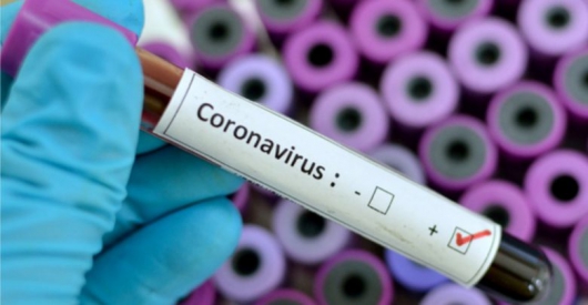 Há razão para temer o coronavírus? Especialistas alertam que a doença é perigosa e que contágio fácil e rápido dificulta controle da infecção