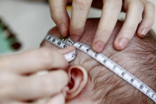 País tem 4 registros de microcefalia por hora; férias podem ampliar surto de zika