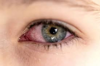 VOLTAS ÀS AULAS: Cartilha sobre saúde ocular na infância orienta pais e professores