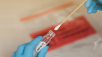 Planos de saúde vão cobrir exames para detecção do novo coronavírus
