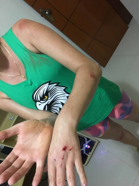 GUANHÃES: Atletas da Equipe Águia tem sido atacados por cães frequentemente durante as corridas