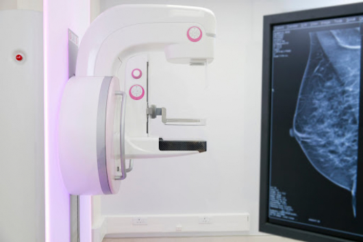 Após mais de três anos suspenso, Guanhães retoma serviço de mamografia em parceria com o HIC