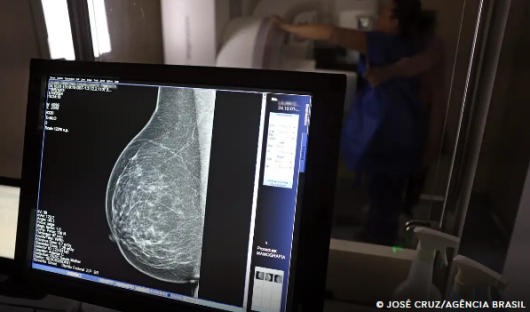 Ministério da Saúde passa a recomendar mamografia a partir dos 40 anos