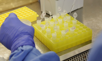 NOTÍCIA BOA: Testes para vacina contra HIV têm resultados promissores