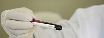 Governo de Minas passa a disponibilizar resultados de exames dos doadores de sangue no MG App