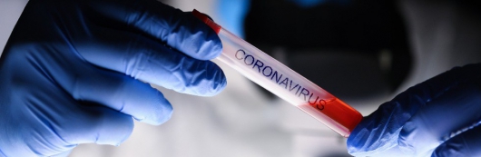 Número de casos suspeitos do novo coronavírus cresce mais de 300% no Brasil