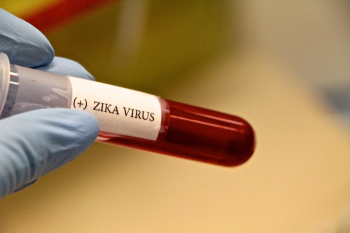 Zika: vacina brasileira é eficaz em camundongos e pode proteger contra complicações da doença