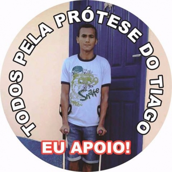 SOLIDARIEDADE:  Jovem serrano com doença grave necessita de doações para compra de prótese