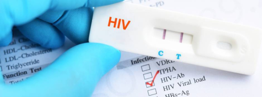 SAÚDE: Dezembro Vermelho chama a atenção para prevenção e combate ao HIV/Aids