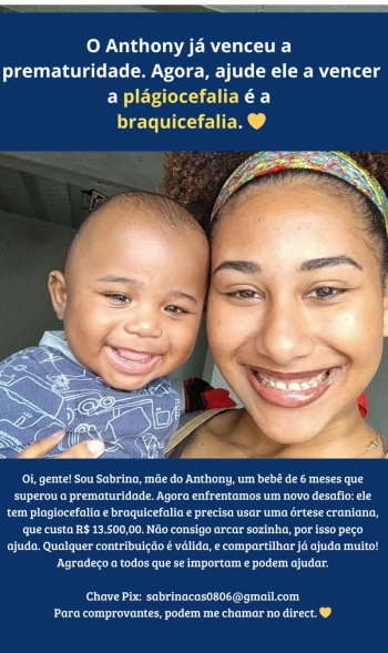 Família de bebê diagnosticado com plagio e braquicefalia conta com ajuda da população para realizar tratamento com custo elevado